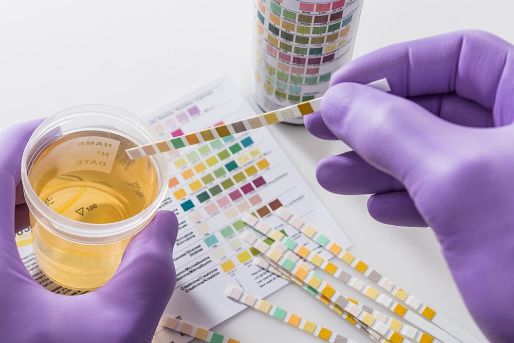 urine drug testing
