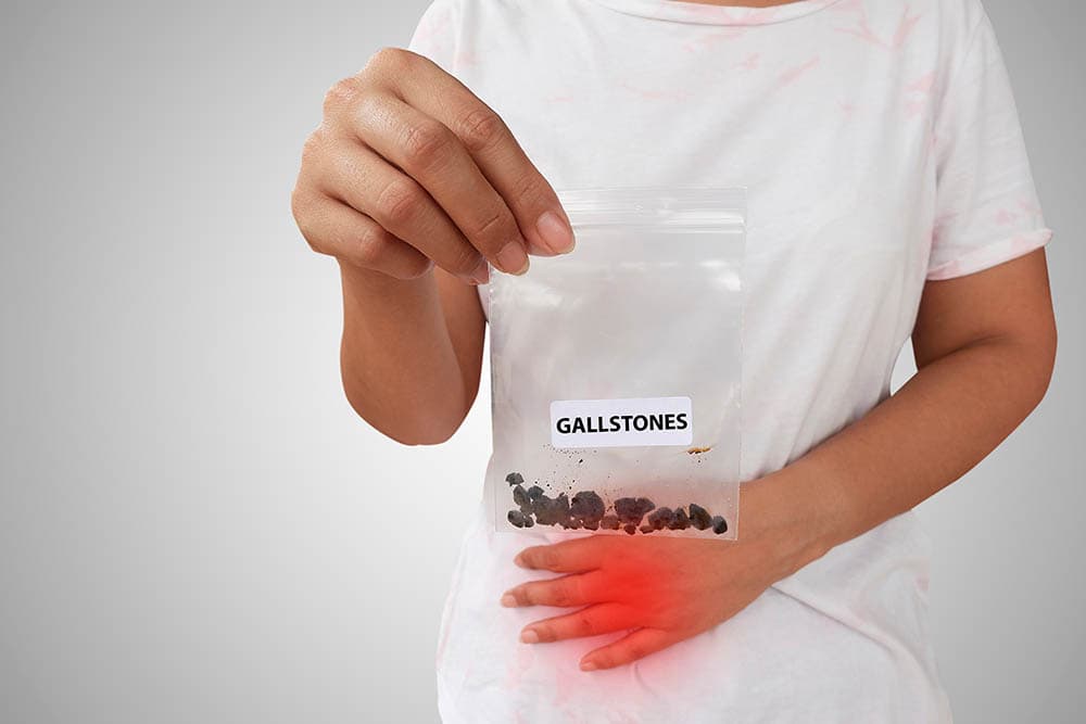 person with gallstones